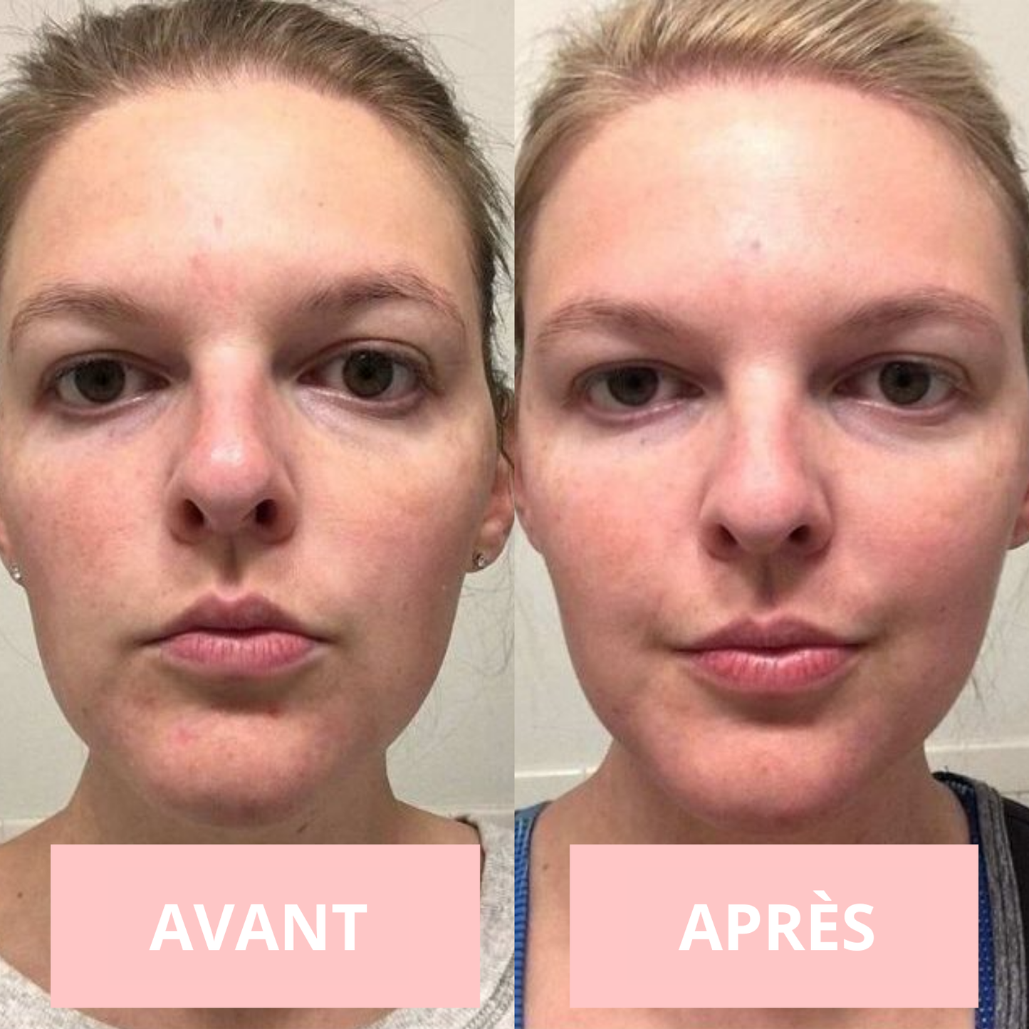 NOVASKIN MASQUE LED VISAGE 7-EN-1