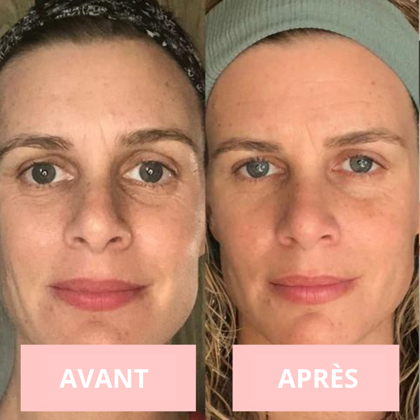 NOVASKIN MASQUE LED VISAGE 7-EN-1