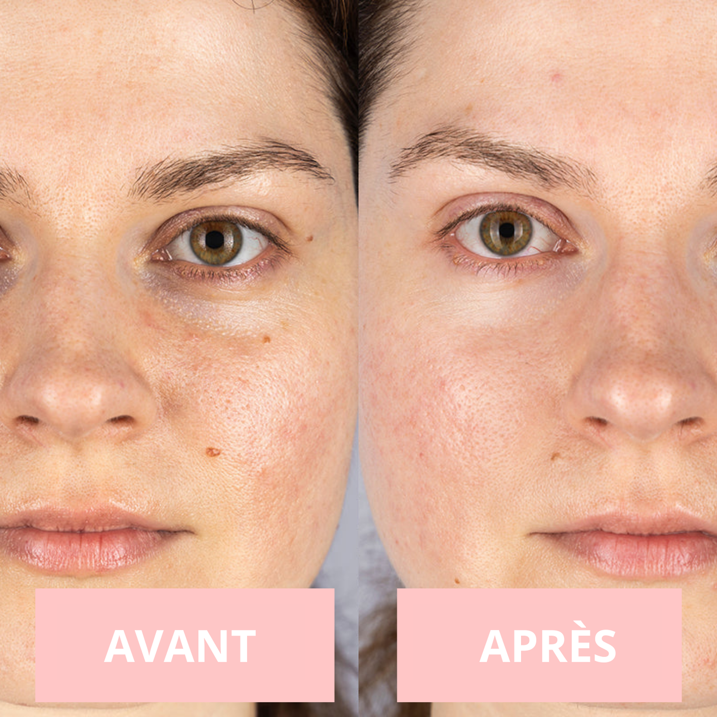 NOVASKIN MASQUE LED VISAGE 7-EN-1