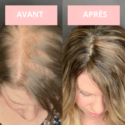 NOVASKIN APPAREIL DE THÉRAPIE VISAGE HAUTE FRÉQUENCE
