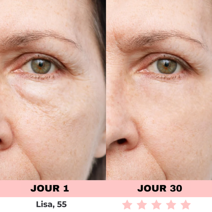 NOVASKIN LUNETTES À LUMIÈRE ROUGE POUR LE CONTOUR DES YEUX