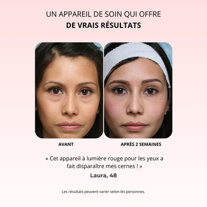 NOVASKIN LUNETTES À LUMIÈRE ROUGE POUR LE CONTOUR DES YEUX