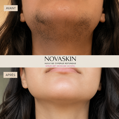 NovaCyper — Sérum Anti-Repousse