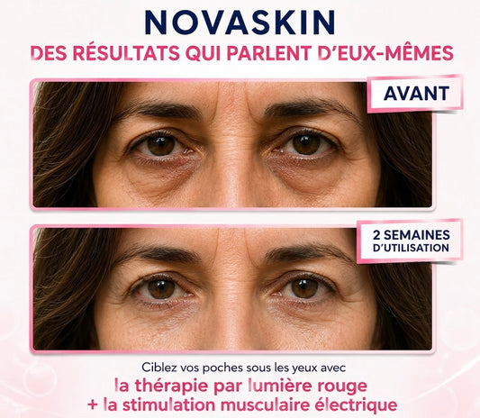 NOVASKIN LUNETTES À LUMIÈRE ROUGE POUR LE CONTOUR DES YEUX