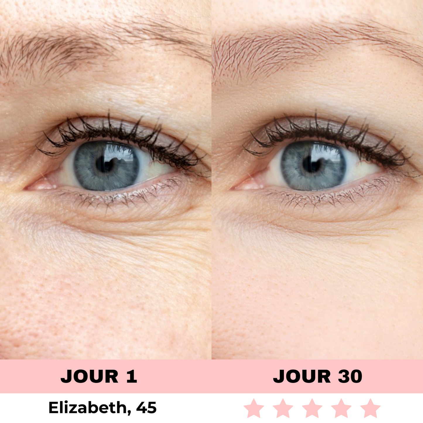 NOVASKIN LUNETTES À LUMIÈRE ROUGE POUR LE CONTOUR DES YEUX