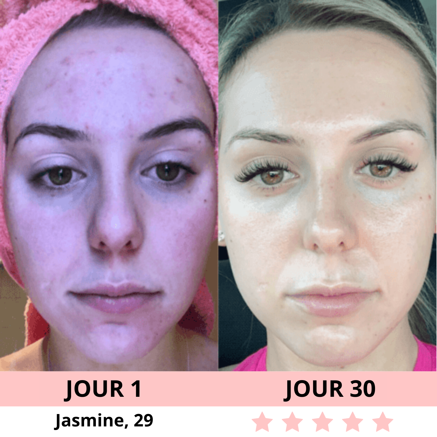 NOVASKIN SCULPTEUR VISAGE LED 7-EN-1