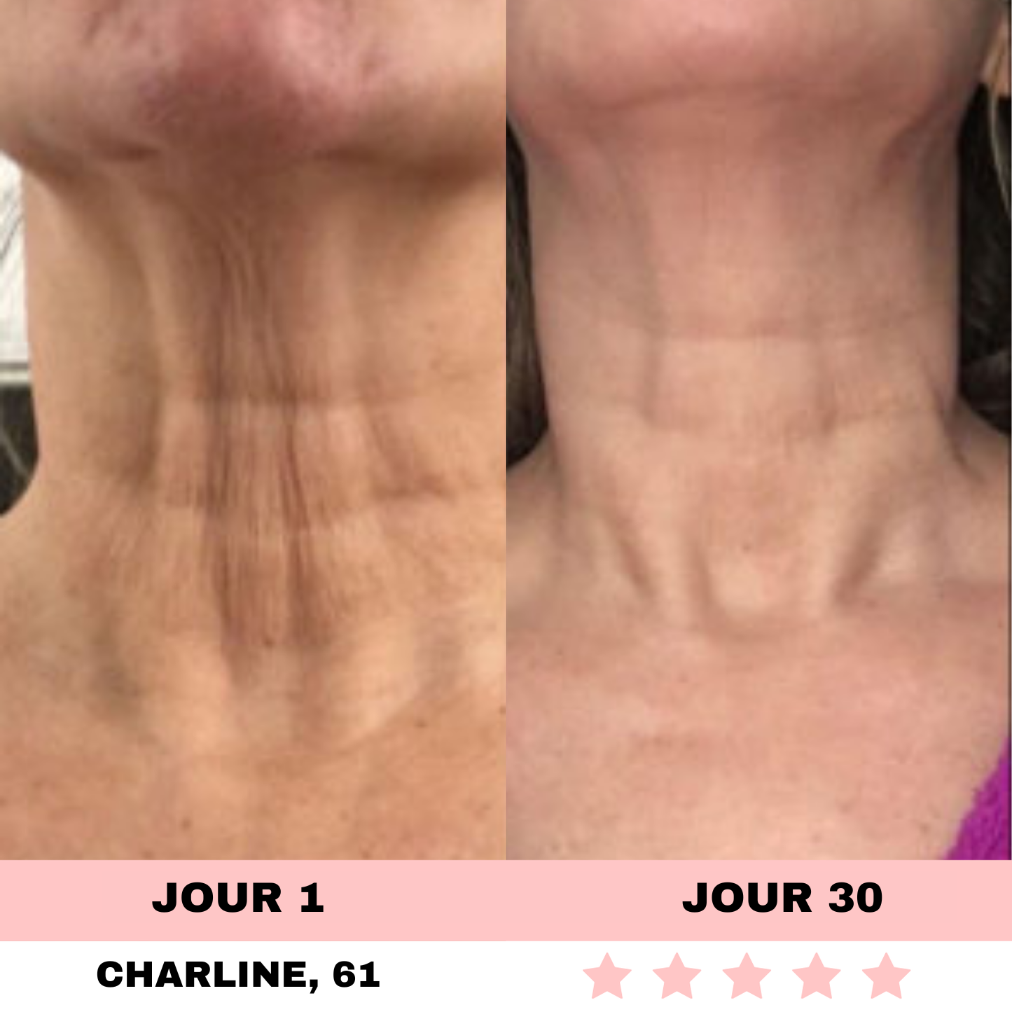 NOVASKIN SCULPTEUR VISAGE LED 7-EN-1