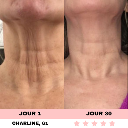 NOVASKIN SCULPTEUR VISAGE LED 7-EN-1