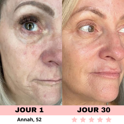 NOVASKIN SCULPTEUR VISAGE LED 7-EN-1