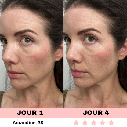 NOVASKIN LUNETTES À LUMIÈRE ROUGE POUR LE CONTOUR DES YEUX