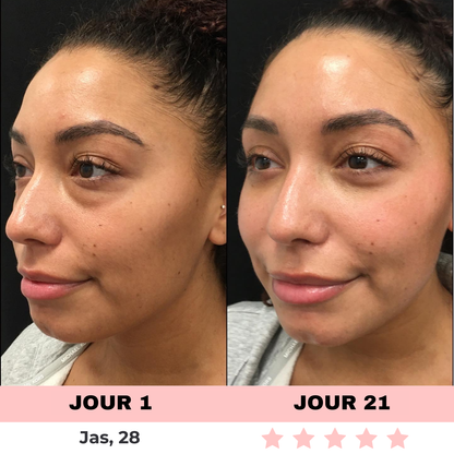 NOVASKIN LUNETTES À LUMIÈRE ROUGE POUR LE CONTOUR DES YEUX