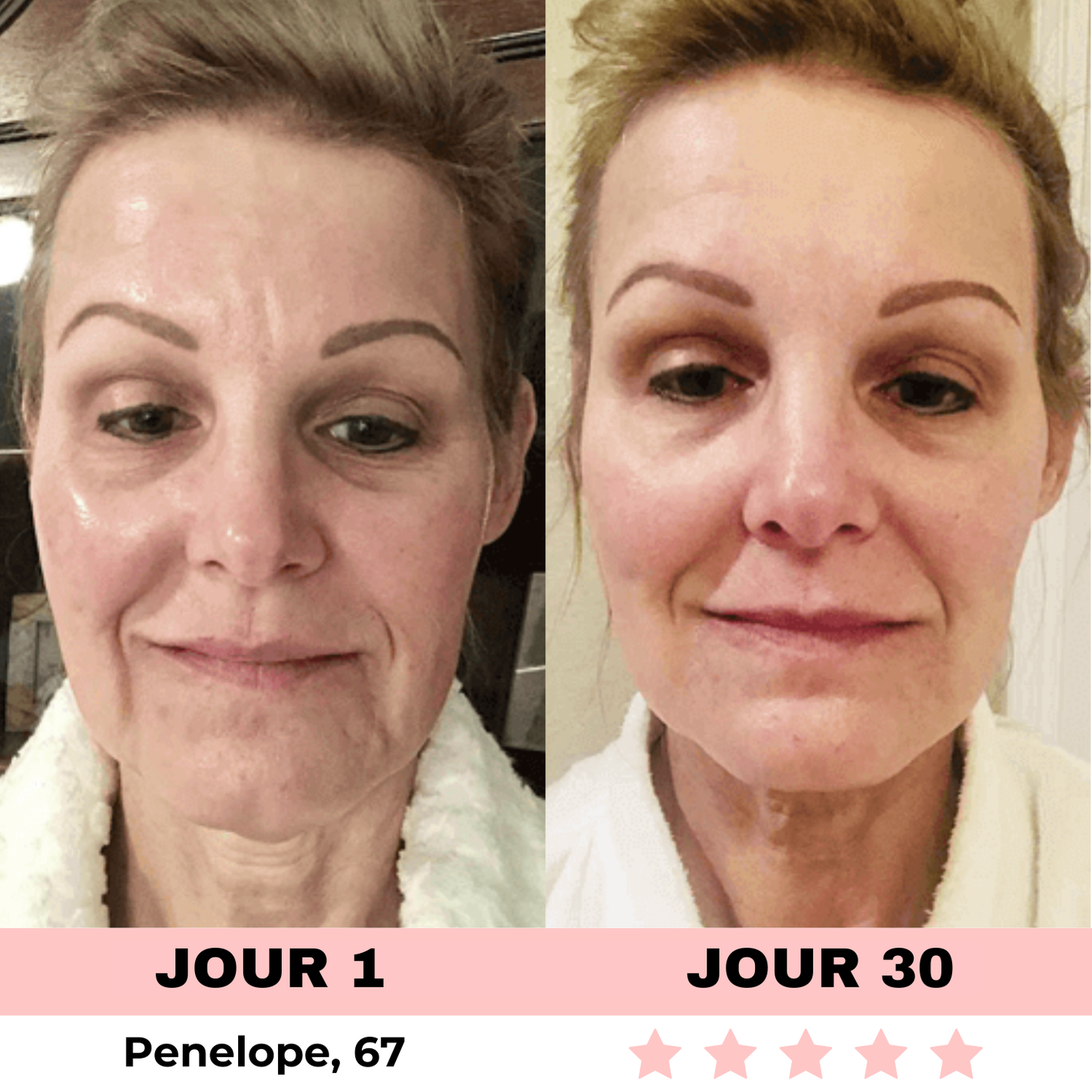 NOVASKIN SCULPTEUR VISAGE LED 7-EN-1