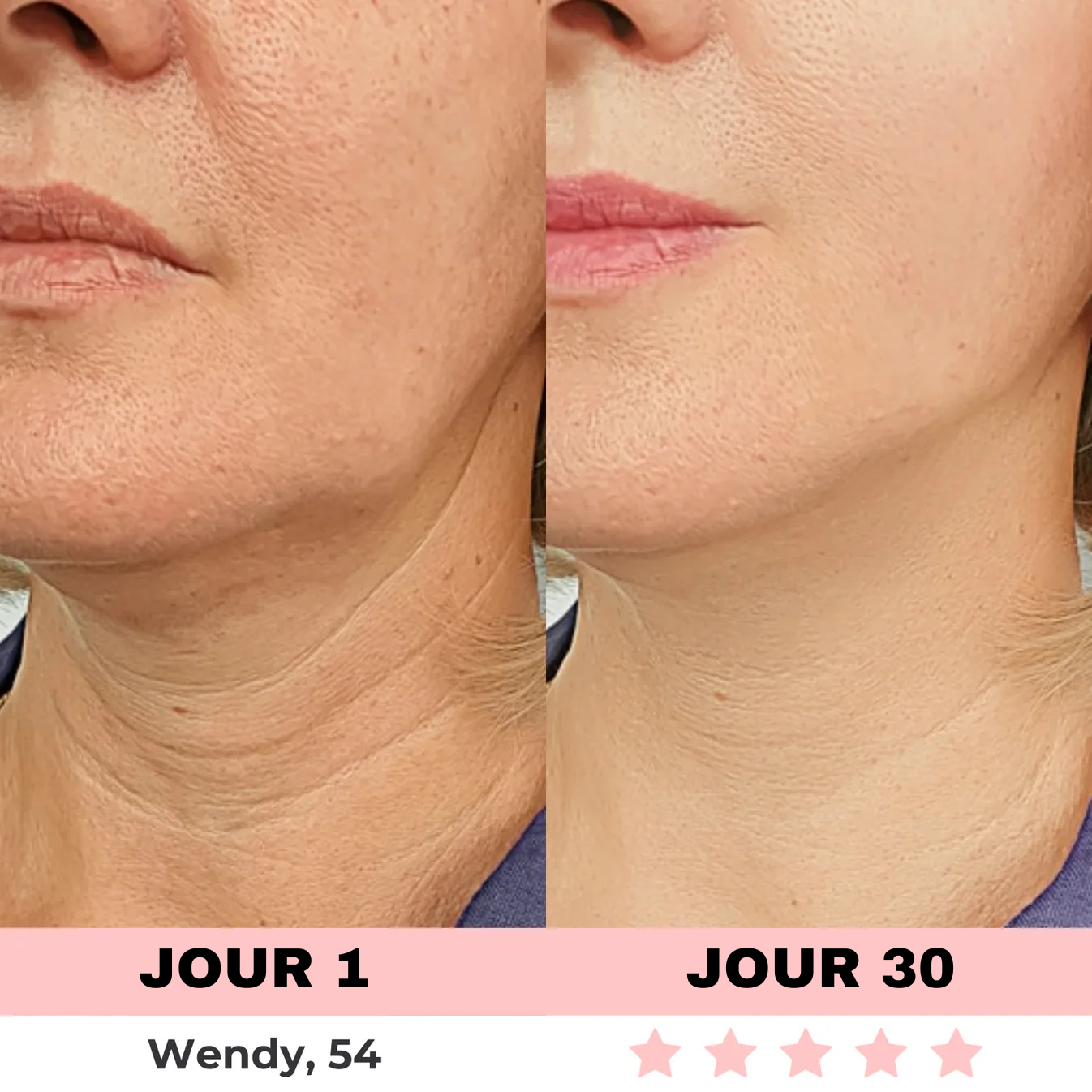 NOVASKIN SCULPTEUR VISAGE LED 7-EN-1