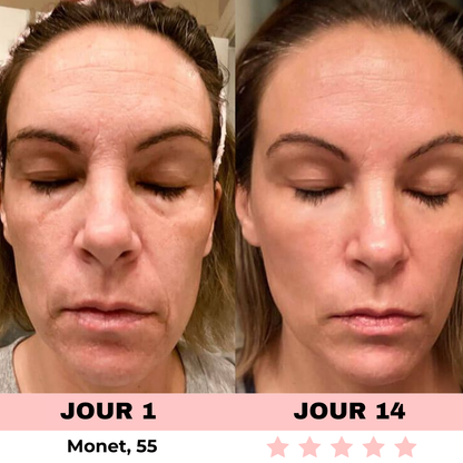 NOVASKIN SCULPTEUR VISAGE LED 7-EN-1