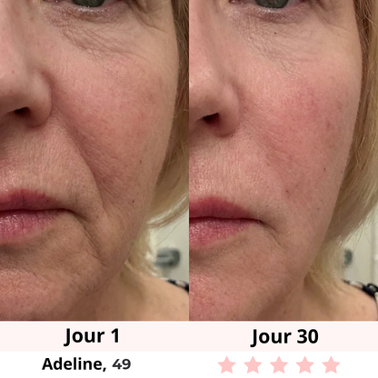 NOVASKIN SCULPTEUR FACIAL LED 7-EN-1