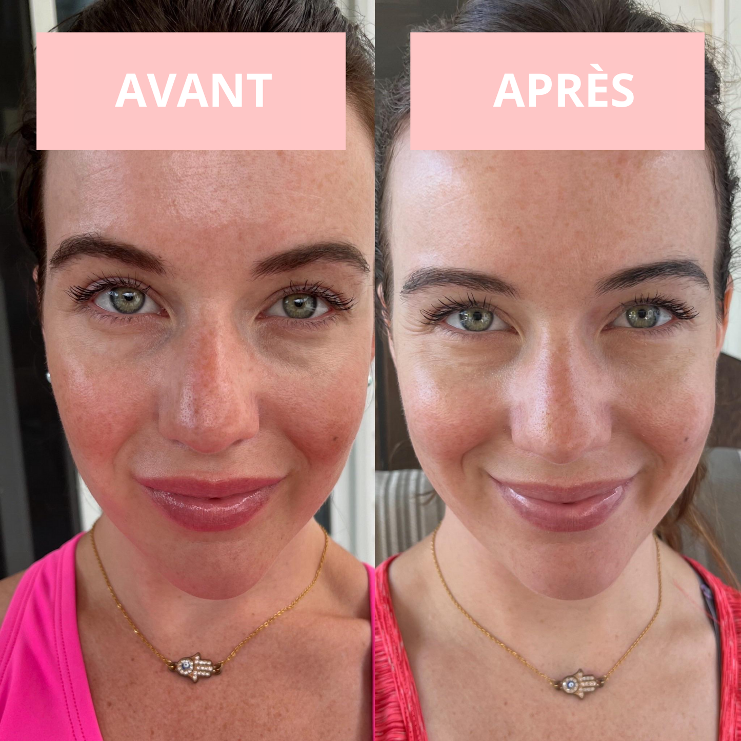 NOVASKIN MASQUE LED VISAGE 7-EN-1